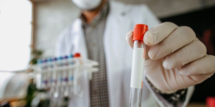 Óbitos por Covid-19 chegam a 87,5% dos municípios cearenses