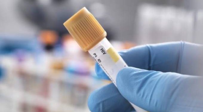 Cientistas brasileiros descobrem terapia que pode curar a AIDS