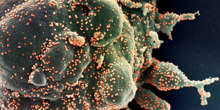 Imunidade contra a Covid pode ser duradoura, diz estudo