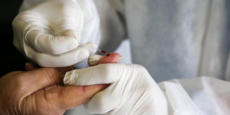 Casos de Covid-19 chegam a 118.311 no Ceará; Estado registra 6.373 mortes