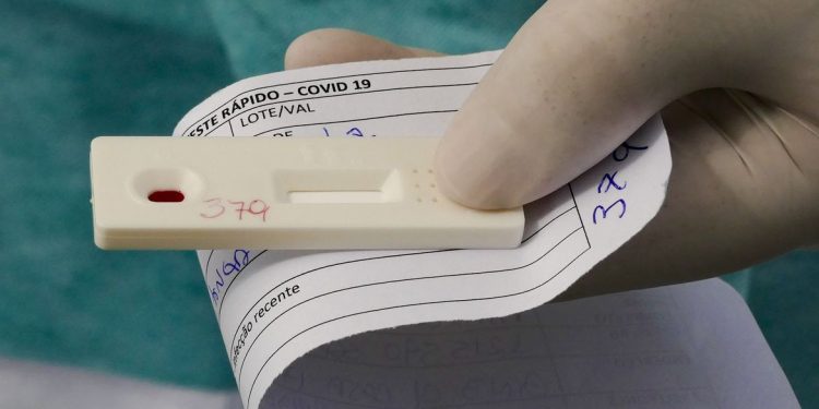 Brasil chega a 2 milhões de casos acumulados de Covid-19