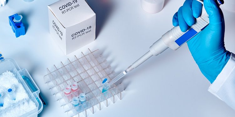 Covid-19: Brasil registra 1.212 óbitos e 52.383 casos nas últimas 24h