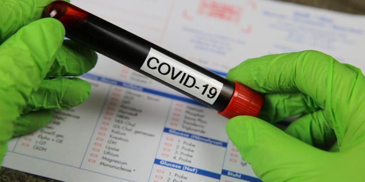 Casos de Covid-19 chegam a 161.844 no Ceará; Estado registra 7.480 mortes