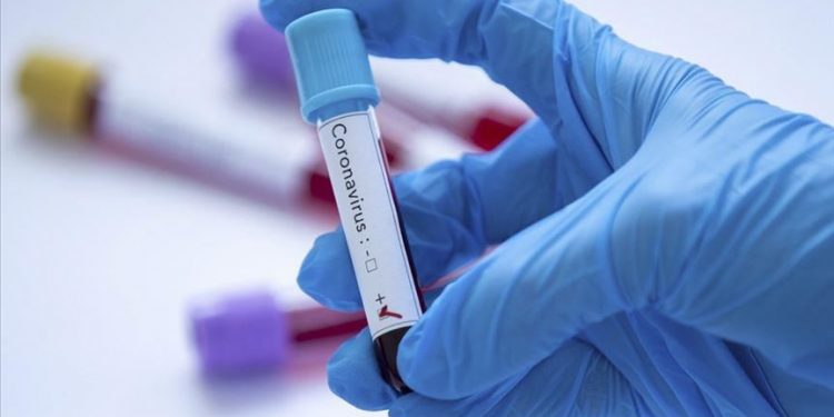 Cidade do Cariri supera a marca dos 4 mil infectados pela Covid-19