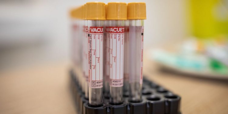 Brasil tem 65,4 mil mortes causadas pela Covid-19