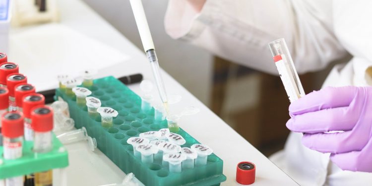 Covid-19: Brasil tem 2,733 milhões de contaminados e 94,1 mil mortos