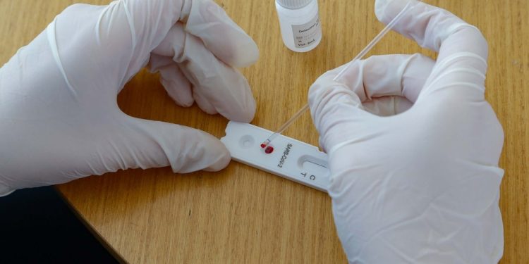 Ceará tem 186.563 diagnósticos positivos para Covid-19; estado ultrapassa meio milhão de testes