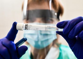 Covid-19: Ceará soma 214.953 casos confirmados; mortes estão em 8.409