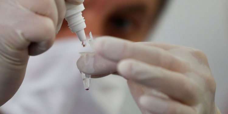 Ceará passa de 202 mil casos de Covid-19; 173.514 pessoas se recuperaram no estado