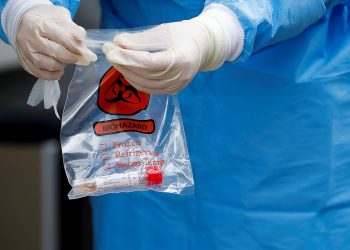 Covid-19: Brasil tem 121,3 mil mortes e 3,9 milhões de casos acumulados