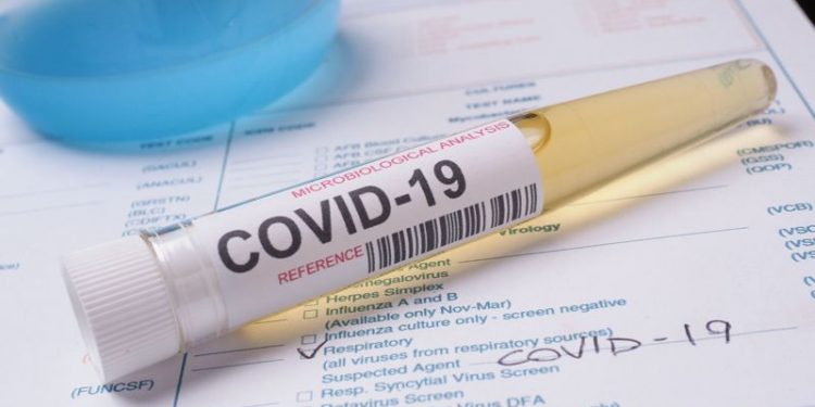 Interior já responde por quase 53% dos casos de Covid-19