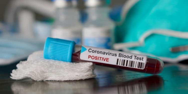 Covid-19: Em três semanas, média de óbitos cai pela metade em Juazeiro do Norte