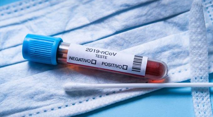 Ceará chega a 7.921 mortes pela Covid-19, com mais de 184 mil casos