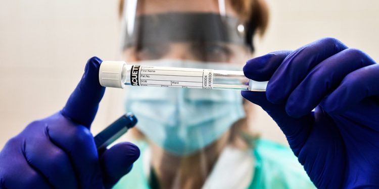 País registra 1.274 mortes por Covid em 24 h; total de óbitos vai a 103.026