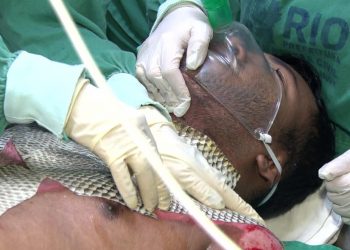 Paciente em tratamento com pele de tilápia (Foto: Reprodução/ TV Globo)