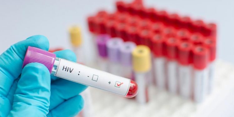 Mulher de 66 anos pode ser 1ª pessoa a se curar do HIV sem tratamento