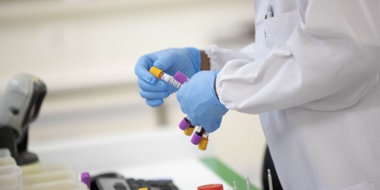 Covid-19: Em uma semana, casos caem 30% e mortes, 13%