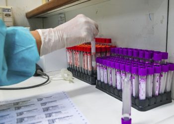 Covid-19: Brasil tem 33,5 mil novos casos e 836 mortes em 24 horas