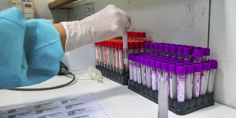 Covid-19: Brasil tem 33,5 mil novos casos e 836 mortes em 24 horas