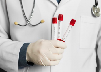 Ceará registra mais de 226 mil casos confirmados da Covid-19; já são 8.683 mortes