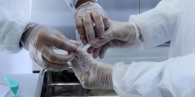 Covid-19: Brasil tem 140 mil mortes e 4,68 milhões de casos acumulados