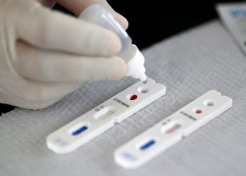 Ceará registra 227.449 casos confirmados de Covid-19; mortes pela doença são 8.686