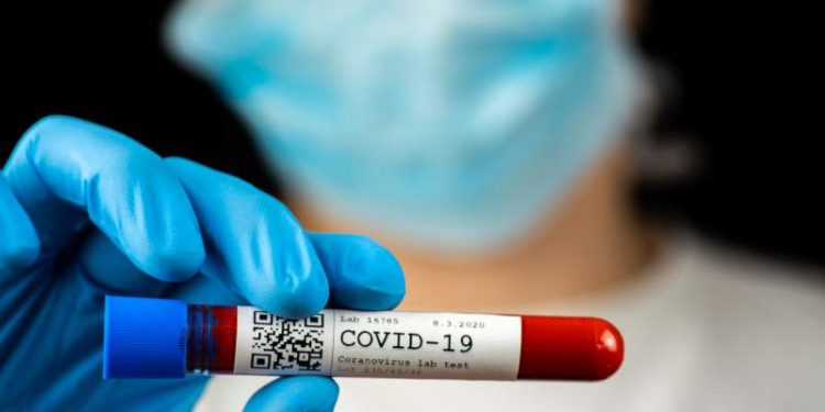 Covid-19: Brasil soma 818 mortes e mais de 32 mil novos casos em 24h