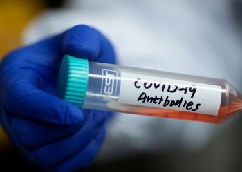 Ceará chega a 8.634 mortes por Covid-19 e ultrapassa 223 mil casos confirmados