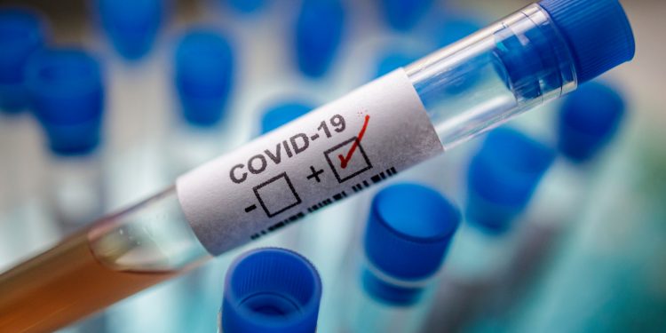 Brasil registra 987 mortes por Covid-19 em 24 horas e passa dos 134 mil óbitos