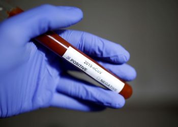 Ceará registra 8.921 óbitos e 239.062 casos confirmados de Covid-19