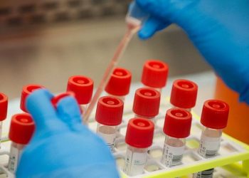 Ceará supera 224 mil casos de Covid-19 e tem 8.657 mortes pela doença