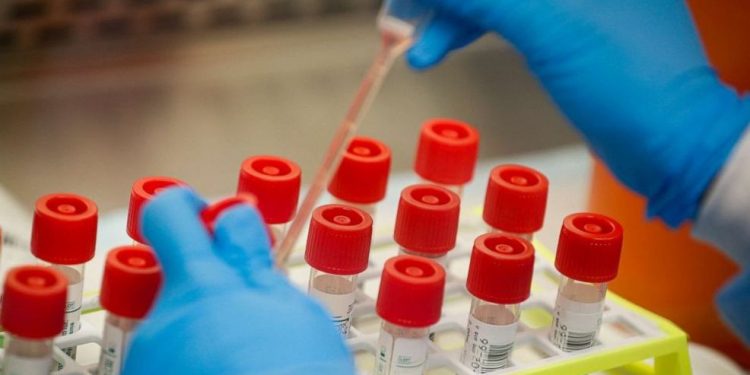 Ceará supera 224 mil casos de Covid-19 e tem 8.657 mortes pela doença