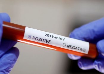 Ceará ultrapassa 233 mil casos de infectados pela Covid-19; o número de recuperados é superior a 206 mil