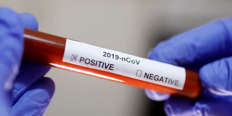 Ceará ultrapassa 233 mil casos de infectados pela Covid-19; o número de recuperados é superior a 206 mil