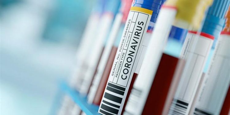 Ceará registra mais de 237 mil casos de Covid-19 com 8.905 óbitos pela doença