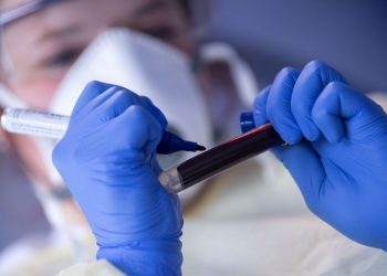 Ceará registra quase 9 mil mortes pela Covid-19 e concentra mais de 241 mil casos confirmados