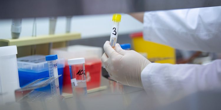 Com três óbitos nas últimas 24h, Ceará tem 232 mil casos de Covid-19 e 8.795 mortes