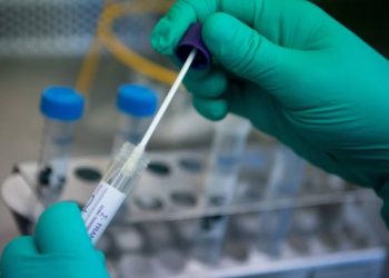 Ceará contabiliza 227.799 casos confirmados de Covid-19 e 8.698 mortes pela doença