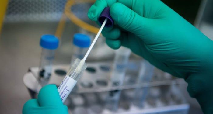 Ceará contabiliza 227.799 casos confirmados de Covid-19 e 8.698 mortes pela doença