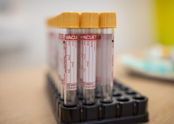 Brasil registra mais de 5 milhões casos de Covid-19 e 150 mil mortes