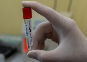 Ceará acumula mais de 262 mil casos e 9.199 óbitos por Covid-19