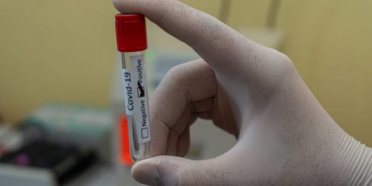 Ceará registra 243.091 casos de Covid-19 e 9.054 mortes