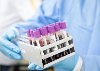 Com média móvel abaixo de 500, Brasil passa de 156 mil mortes por Covid-19