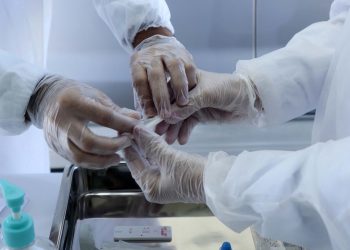 Ceará acumula mais de 262 mil casos e 9.199 óbitos por Covid-19