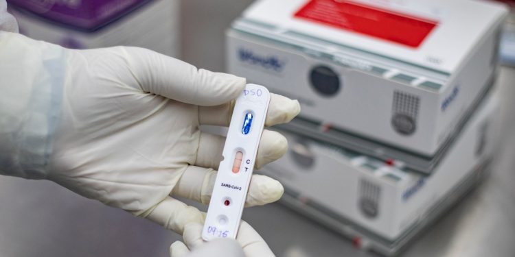 Covid-19: Brasil registra 365 mortes e 8.456 novos casos em 24 horas