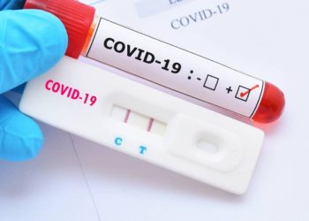 Média móvel de mortes chega a 501, mas Brasil ainda tem 10 mil casos em 24h