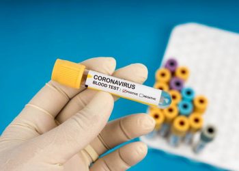 Brasil tem mais 263 mortes e 15.726 novos casos de Covid-19