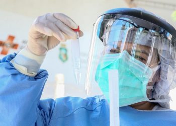 Ceará investiga 160 pacientes que testaram positivo duas vezes para o novo coronavírus