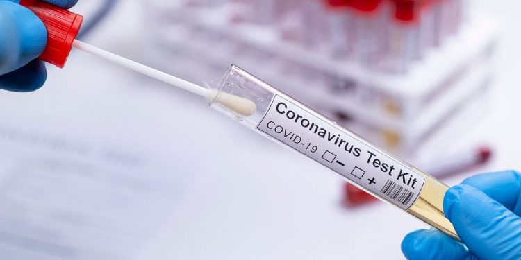 Covid-19: já são mais de 272 mil diagnósticos positivos e 9.326 mortes no Ceará