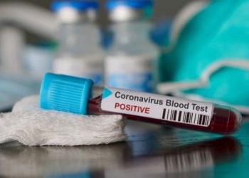 Ceará confirma 9.293 mortes pela Covid-19 e tem mais de 270,8 mil casos